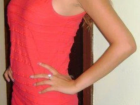 Opis slike