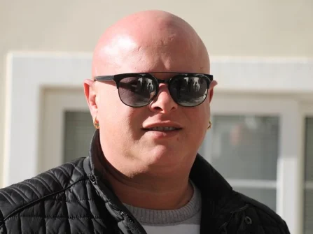 Opis slike
