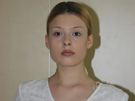 Opis slike