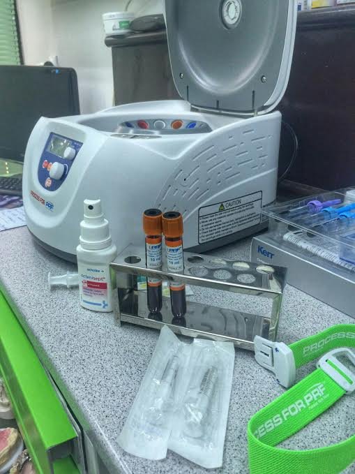 1 Plazmolir5int (medicinski tretman lica)