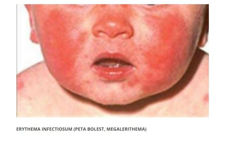 Zavod za javno zdravstvo DNŽ